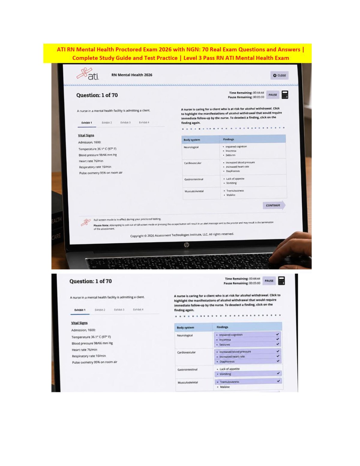 Verified ATI RN Mental Health 2023/2026 NGN | 70 Screenshot Questions and Answers