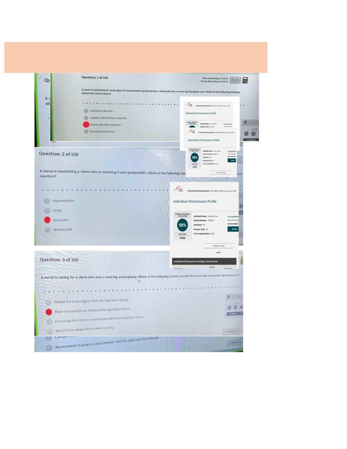 ATI RN Adult Medical Surgical (Med-Surg) 2023/2026 | Actual Study Questions and Practice Test (Screenshot Q&A)